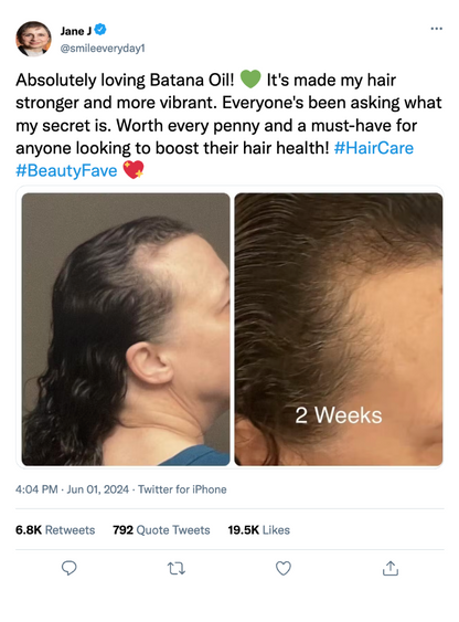 Hair Revival Oil™